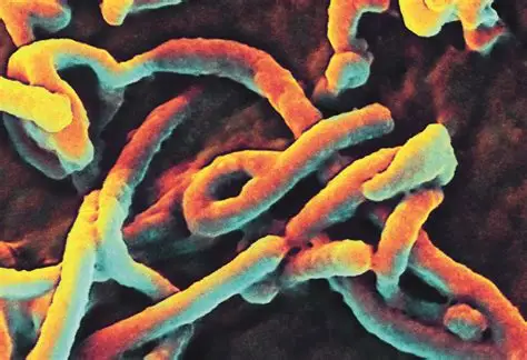 Nigeria confirms Ebola case in FCT as health authorities begin containment